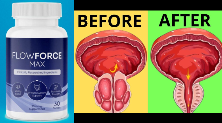 FlowForce Max vs. Other Male Supplements: What Sets It Apart?