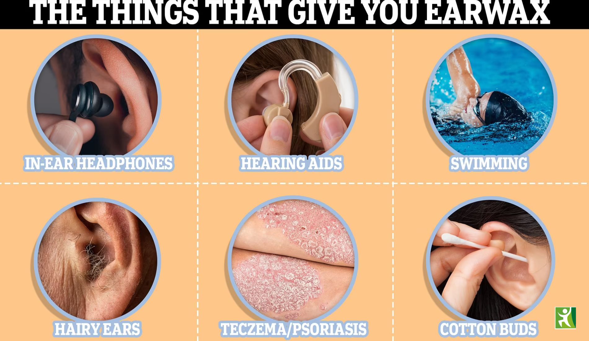 What You Need to Know About Earwax