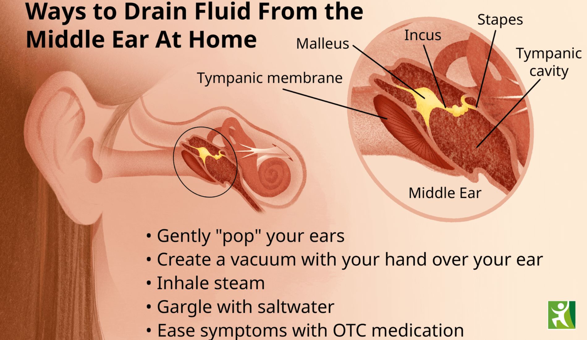 Understanding Ear Infections – Causes & Symptoms